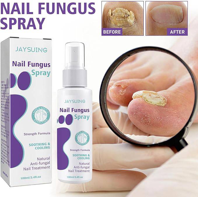 Nail Fungus Spray - Goldiesbliss