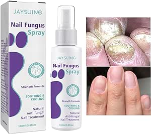 Nail Fungus Spray - Goldiesbliss